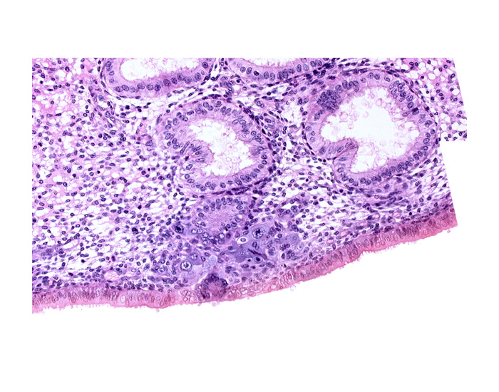 edematous endometrial stroma (decidua), endometrial epithelium, endometrial gland, endometrial sinusoid, solid syncytiotrophoblast