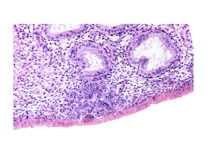 edematous endometrial stroma (decidua), endometrial epithelium, endometrial sinusoid, lumen of endometrial gland, solid syncytiotrophoblast