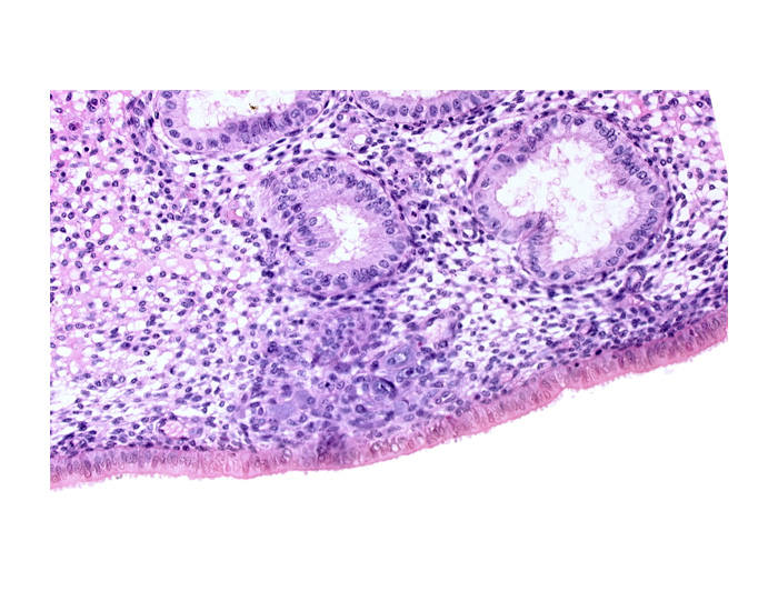 endometrial epithelium, endometrial gland, endometrial sinusoid, solid syncytiotrophoblast, uterine cavity