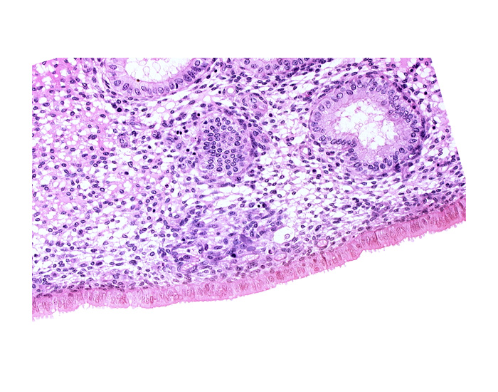 edematous endometrial stroma (decidua), endometrial gland, endometrial sinusoid, intact endometrial epithelium, solid syncytiotrophoblast, uterine cavity