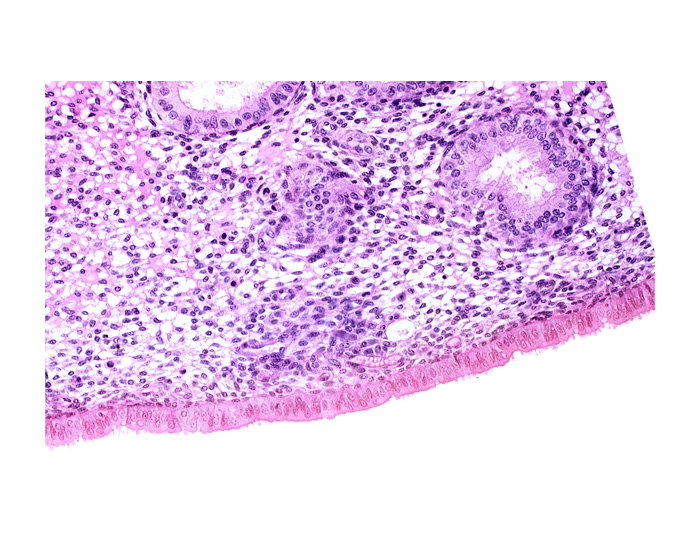 edematous endometrial stroma (decidua), edge of endometrial gland, edge of syncytiotrophoblast, endometrial sinusoid, intact endometrial epithelium