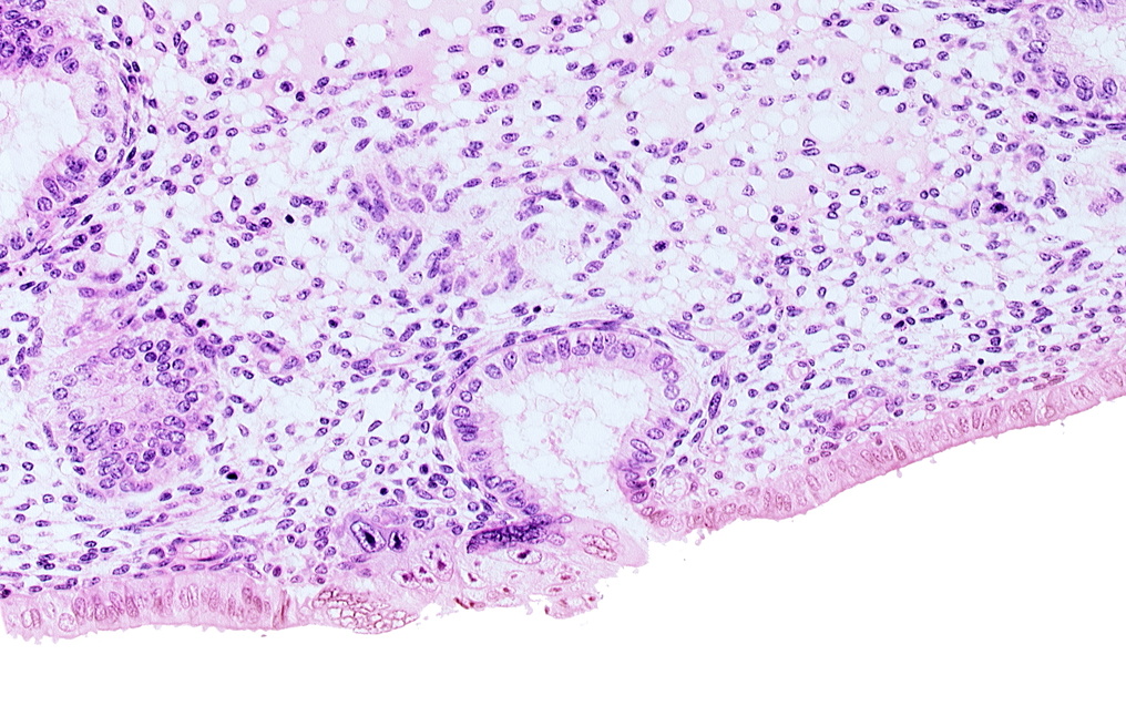 endometrial epithelium, lumen of endometrial gland, mouth of endometrial gland, solid syncytiotrophoblast