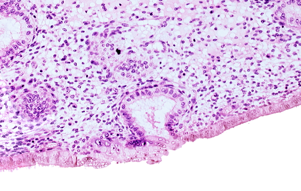 edematous endometrial stroma (decidua), endometrial epithelium, lumen of endometrial gland, solid syncytiotrophoblast