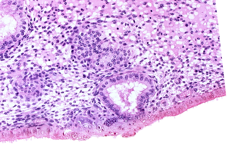 disrupted endometrial epithelium, edematous endometrial stroma (decidua), endometrial epithelium, lumen of endometrial gland, syncytiotrophoblast