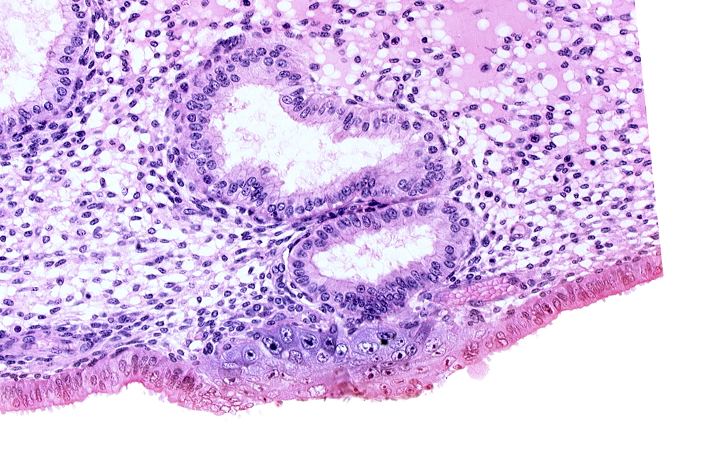 cytotrophoblast, edematous endometrial stroma (decidua), endometrial epithelium, endometrial gland, interrupted endometrial epithelium, solid syncytiotrophoblast, uterine cavity