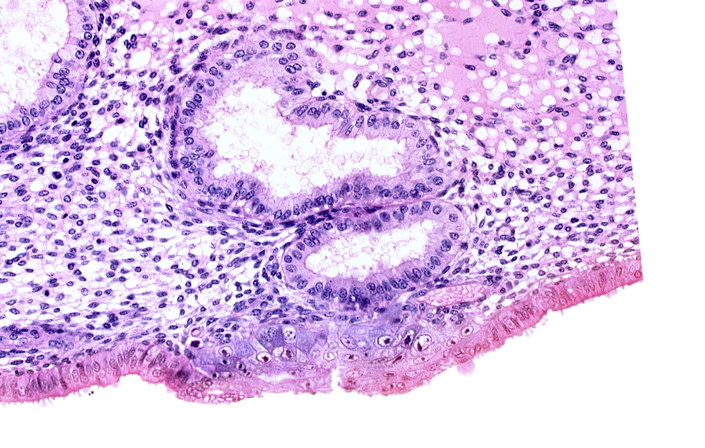 cytotrophoblast, edematous endometrial stroma (decidua), edge of blastocystic cavity (blastocoele), endometrial epithelium, endometrial gland, solid syncytiotrophoblast, uterine cavity