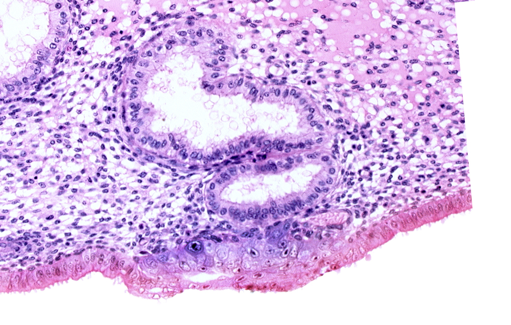 blastocystic cavity (blastocoele), cytotrophoblast, edematous endometrial stroma (decidua), endometrial epithelium, lumen of endometrial gland, solid syncytiotrophoblast