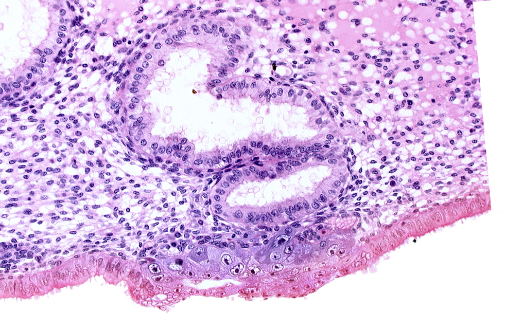 blastocystic cavity (blastocoele), cytotrophoblast, edematous endometrial stroma (decidua), extra-embryonic mesoblast, membranous trophoblast at abembryonic pole, solid syncytiotrophoblast, uterine cavity