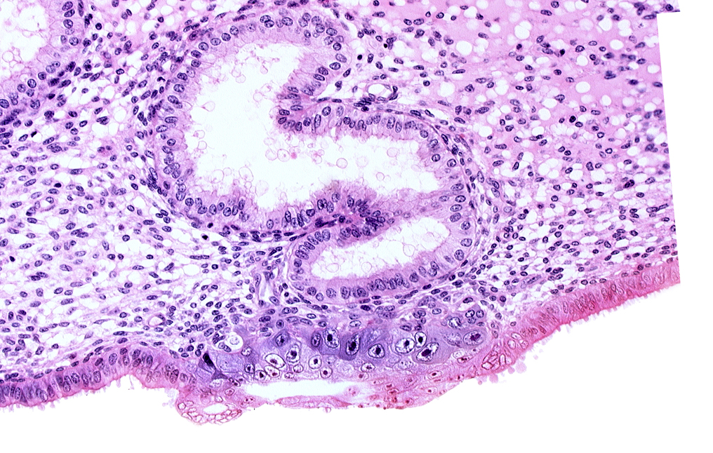 blastocystic cavity (blastocoele), cytotrophoblast, edematous endometrial stroma (decidua), endometrial gland, solid syncytiotrophoblast, syncytiotrophoblast / decidua interface, trophoblast