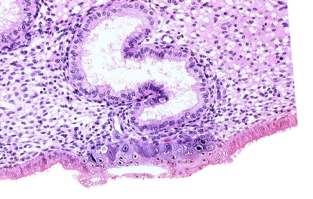 blastocystic cavity (blastocoele), cytotrophoblast, endometrial epithelium, endometrial sinusoid, extra-embryonic endoblast, lumen of endometrial gland, membranous trophoblast at abembryonic pole, solid syncytiotrophoblast, uterine cavity