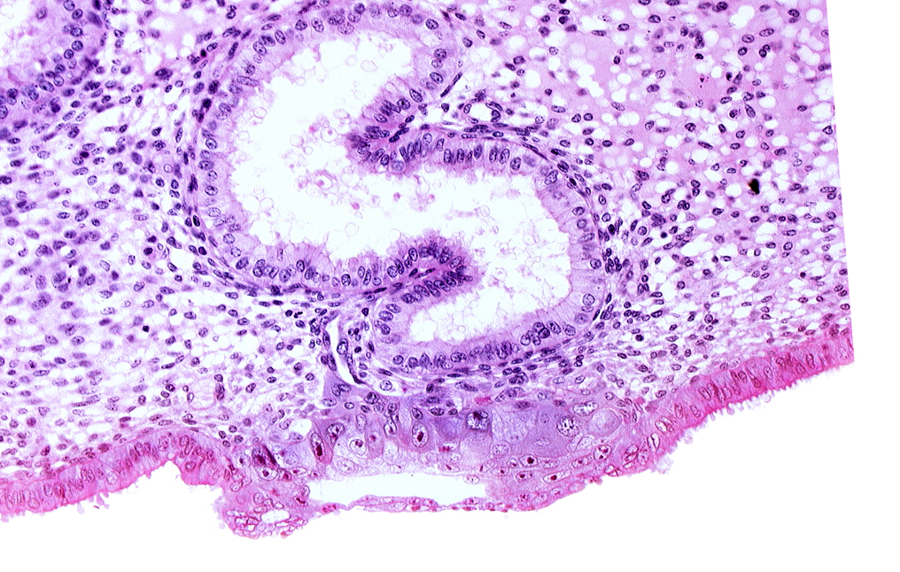 blastocystic cavity (blastocoele), cytotrophoblast, endometrial epithelium, endometrial sinusoid, lumen of endometrial gland, solid syncytiotrophoblast, trophoblast