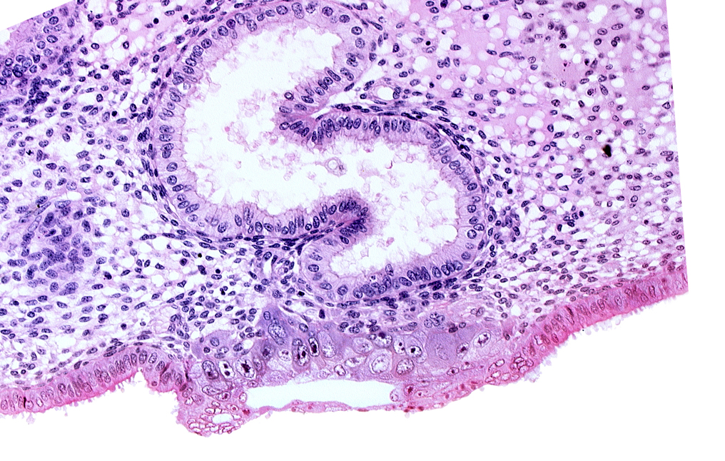 blastocystic cavity (blastocoele), cytotrophoblast, edematous endometrial stroma (decidua), endometrial sinusoid, solid syncytiotrophoblast, syncytiotrophoblast / decidua interface, trophoblast, uterine cavity