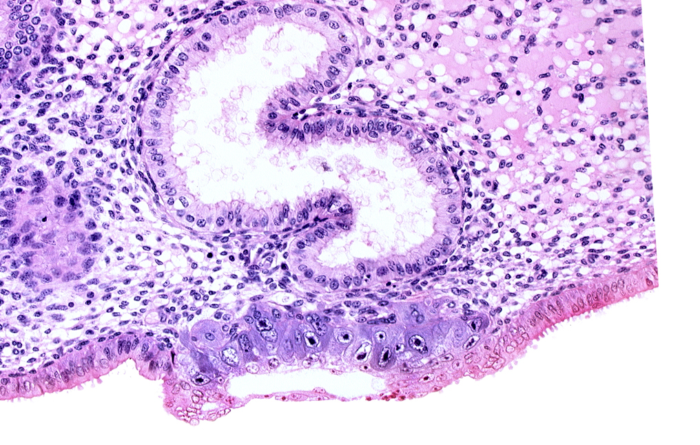 blastocystic cavity (blastocoele), endometrial epithelium, endometrial gland, endometrial sinusoid, solid syncytiotrophoblast, trophoblast