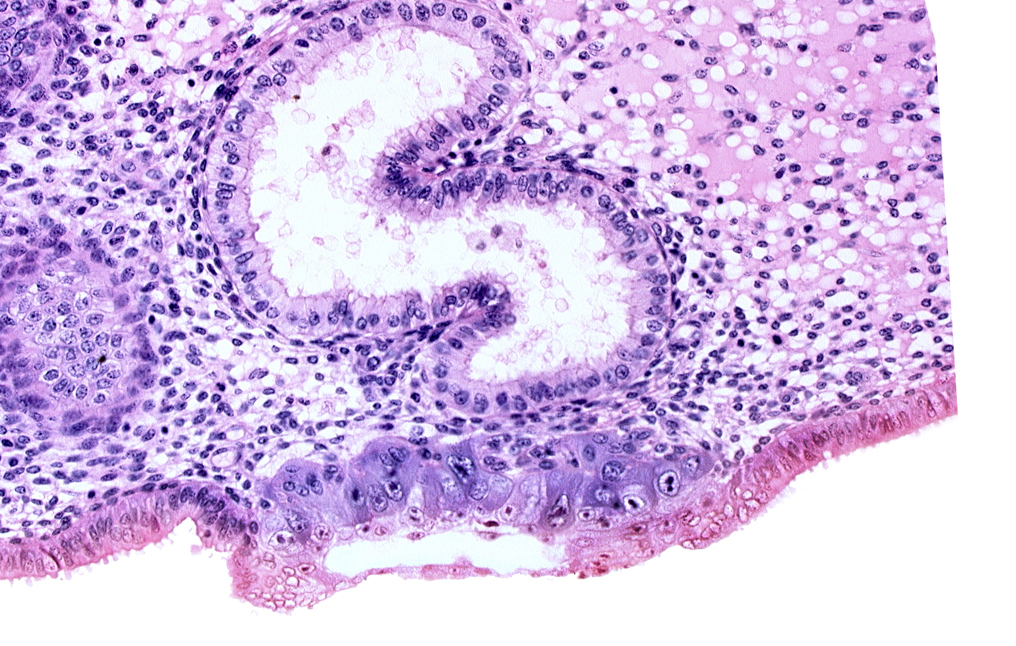 blastocystic cavity (blastocoele), cytotrophoblast, edematous endometrial stroma (decidua), extra-embryonic mesoblast, solid syncytiotrophoblast, trophoblast