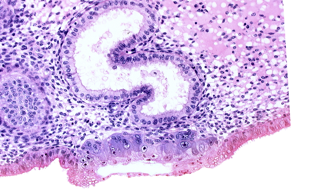 blastocystic cavity (blastocoele), cytotrophoblast, endometrial epithelium, solid syncytiotrophoblast, trophoblast, uterine cavity