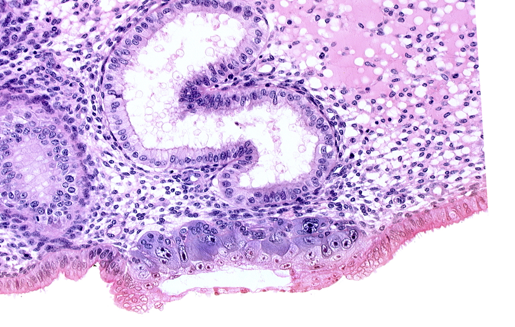 blastocystic cavity (blastocoele), cytotrophoblast, edematous endometrial stroma (decidua), endometrial epithelium, solid syncytiotrophoblast, trophoblast