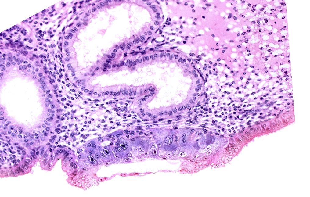 blastocystic cavity (blastocoele), cytotrophoblast, endometrial epithelium, membranous trophoblast at abembryonic pole, solid syncytiotrophoblast