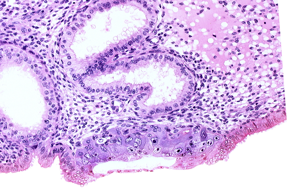 blastocystic cavity (blastocoele), cytotrophoblast, edematous endometrial stroma (decidua), endometrial epithelium, membranous trophoblast at abembryonic pole, solid syncytiotrophoblast, uterine cavity