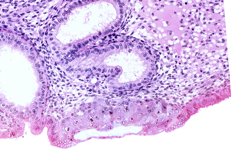 blastocystic cavity (blastocoele), cytotrophoblast, edge of amniotic cavity, edge of embryonic disc, lumen of endometrial gland, membranous trophoblast at abembryonic pole, solid syncytiotrophoblast