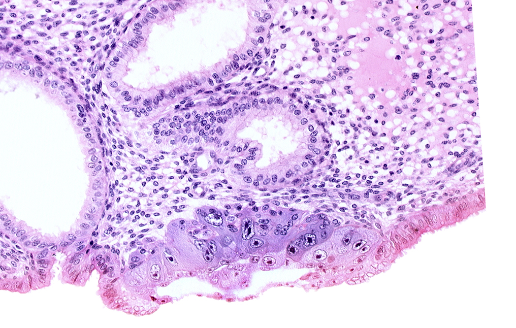 amnioblast(s), amniotic cavity, endometrial sinusoid, epiblast, extra-embryonic mesoblast, hypoblast, membranous trophoblast at abembryonic pole