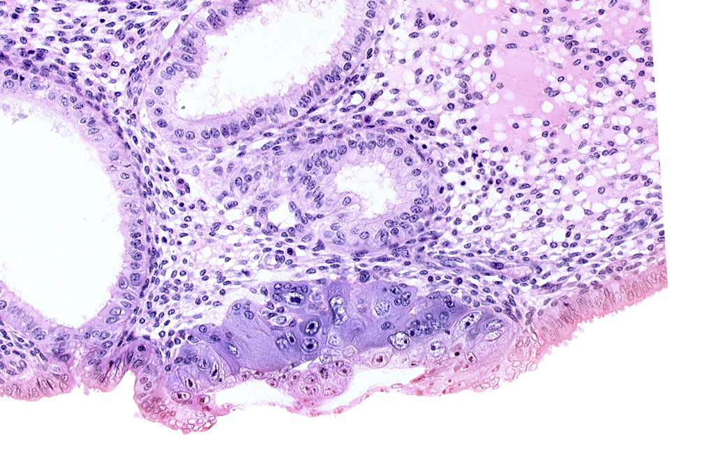 amniotic cavity, blastocystic cavity (blastocoele), cytotrophoblast, edematous endometrial stroma (decidua), endometrial epithelium, endometrial gland, endometrial sinusoid, lumen of endometrial gland, solid syncytiotrophoblast