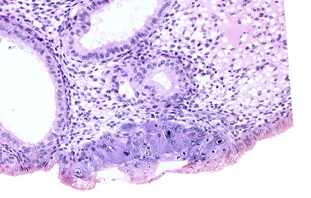 amniotic cavity, cytotrophoblast, endometrial gland, endometrial sinusoid, epiblast, hypoblast, syncytiotrophoblast / decidua interface
