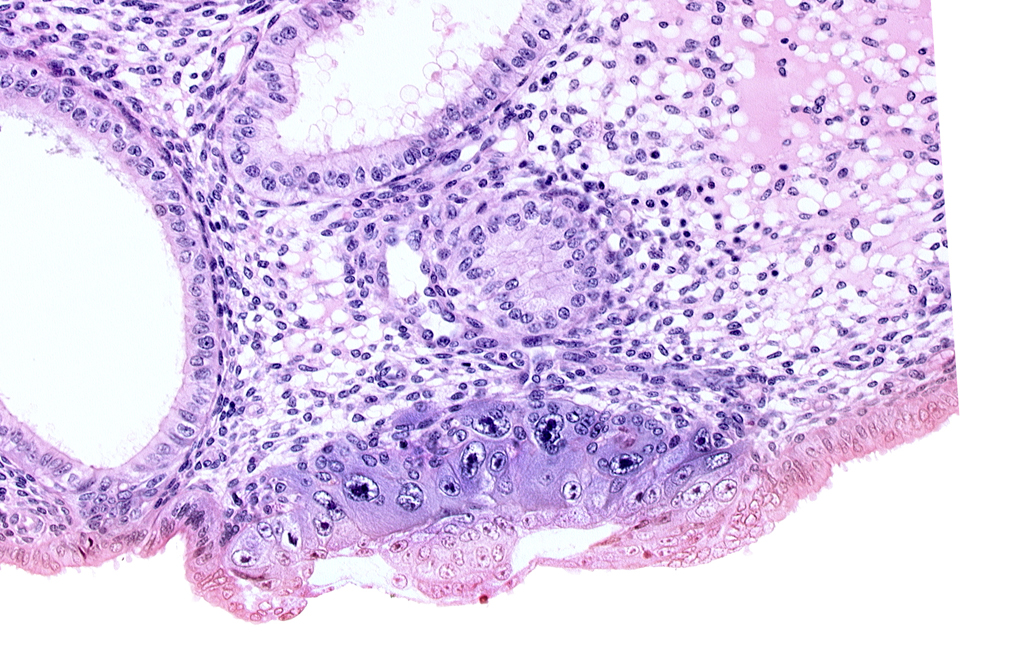 amnioblast(s), blastocystic cavity (blastocoele), cytotrophoblast, embryonic disc, endometrial sinusoid, lumen of endometrial gland, membranous trophoblast at abembryonic pole, solid syncytiotrophoblast, uterine cavity