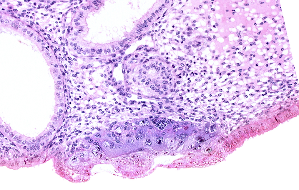 blastocystic cavity (blastocoele), endometrial epithelium, endometrial sinusoid, epiblast, hypoblast, membranous trophoblast at abembryonic pole