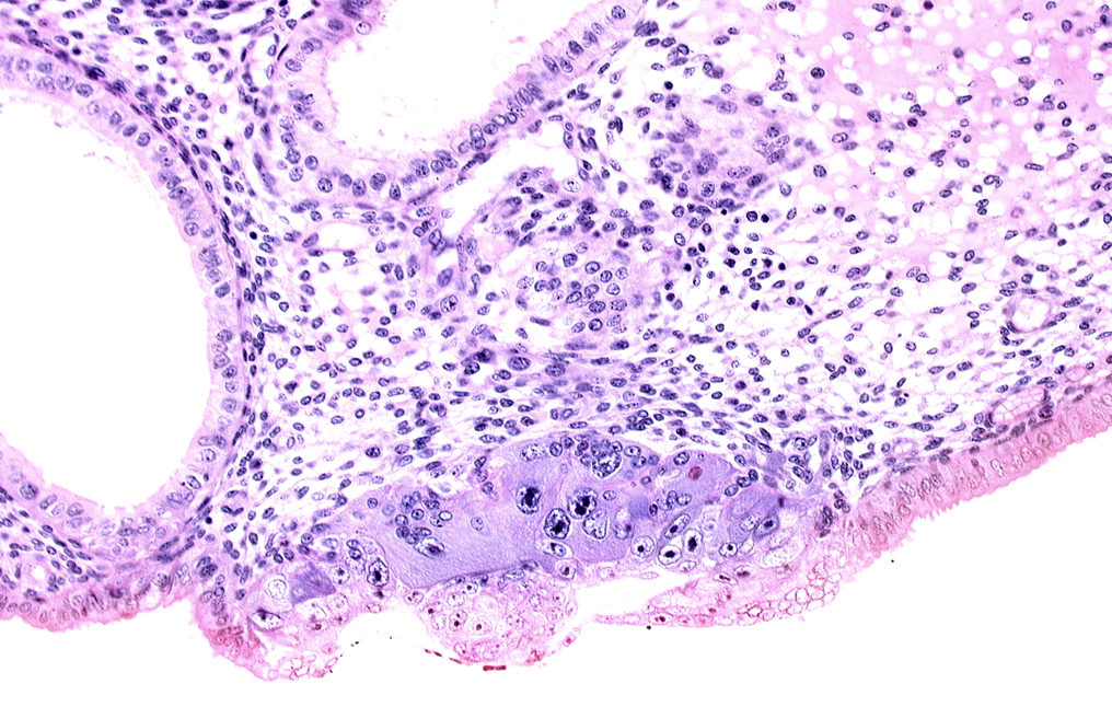 blastocystic cavity (blastocoele), embryonic disc, endometrial sinusoid, membranous trophoblast at abembryonic pole, syncytiotrophoblast / decidua interface