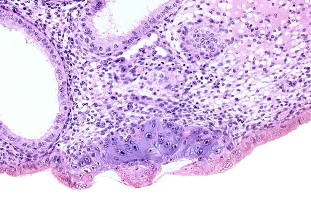 amniotic cavity, blastocystic cavity (blastocoele), embryonic disc, endometrial epithelium, endometrial sinusoid, membranous trophoblast at abembryonic pole