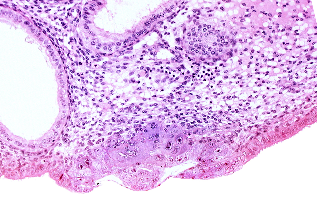 amniotic cavity, blastocystic cavity (blastocoele), edematous endometrial stroma (decidua), endometrial epithelium, lumen of endometrial gland, membranous trophoblast at abembryonic pole