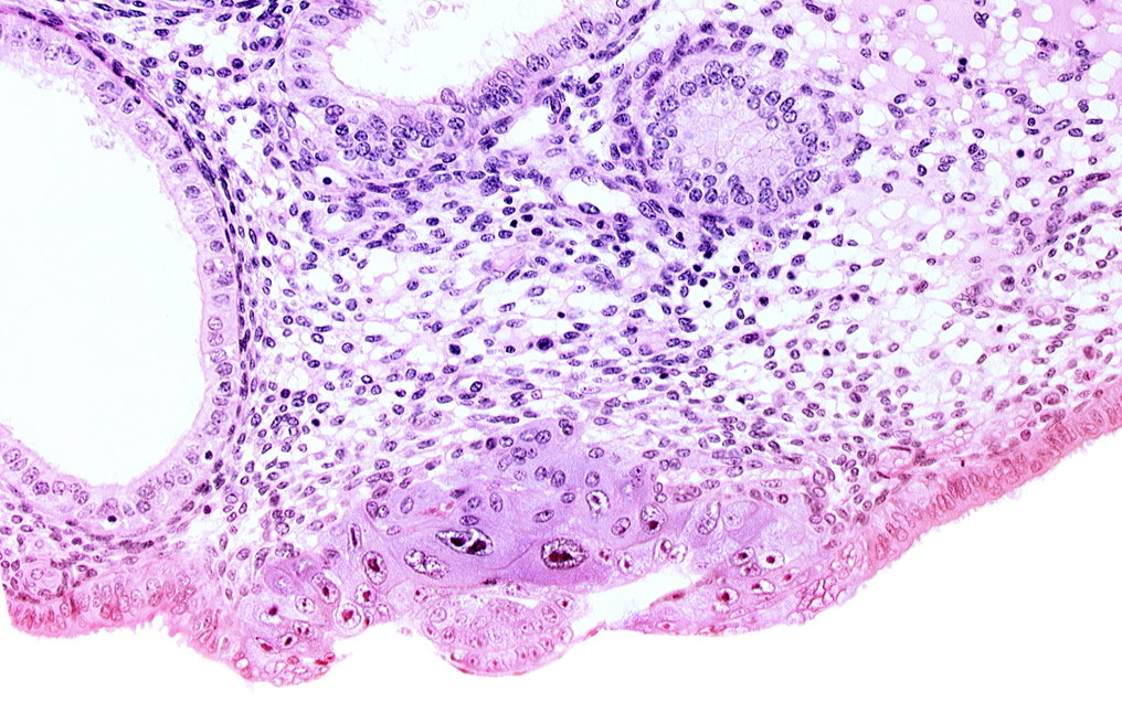 amniotic cavity, blastocystic cavity (blastocoele), cytotrophoblast, embryonic disc, endometrial gland, endometrial sinusoid, solid syncytiotrophoblast, uterine cavity