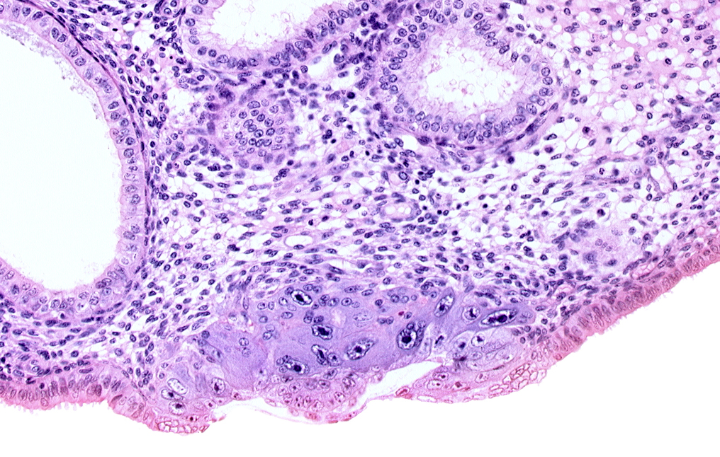 blastocystic cavity (blastocoele), edge of endometrial sinusoid, embryonic disc, endometrial gland, membranous trophoblast at abembryonic pole, solid syncytiotrophoblast, uterine cavity