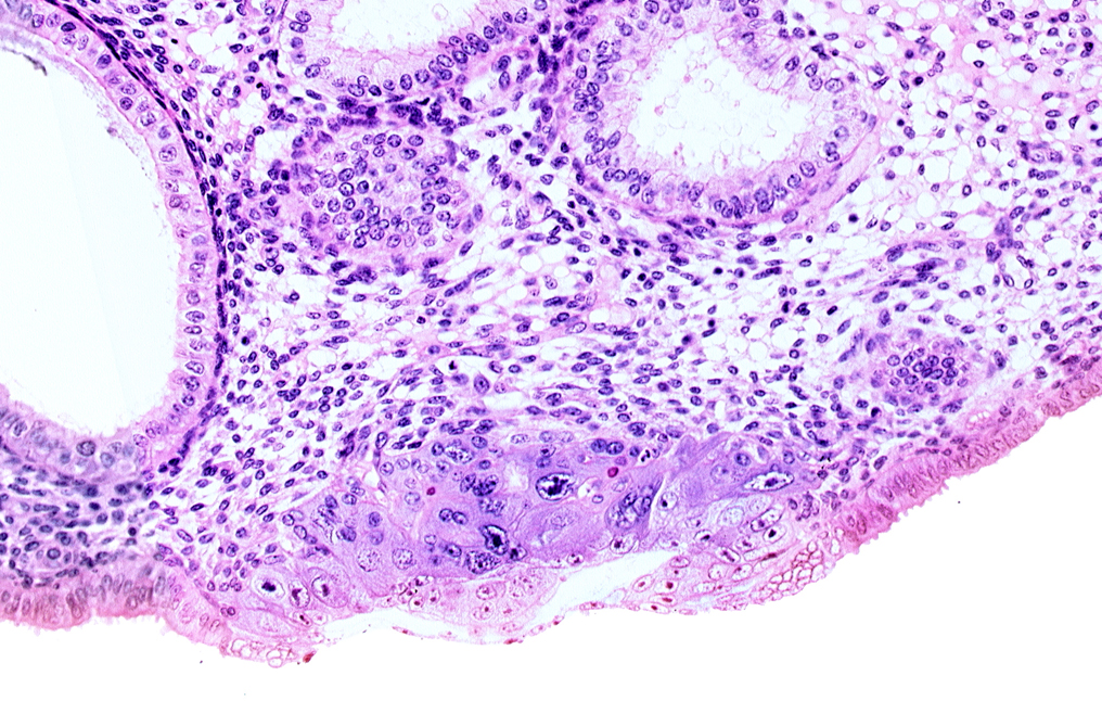 amniotic cavity, blastocystic cavity (blastocoele), cytotrophoblast, embryonic disc, endometrial gland, endometrial sinusoid, lumen of endometrial gland, membranous trophoblast at abembryonic pole