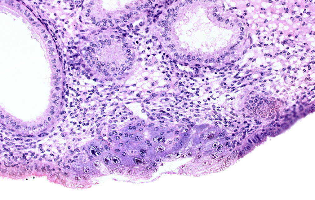 amniotic cavity, blastocystic cavity (blastocoele), endometrial sinusoid, epiblast, extra-embryonic mesoblast, hypoblast, membranous trophoblast at abembryonic pole