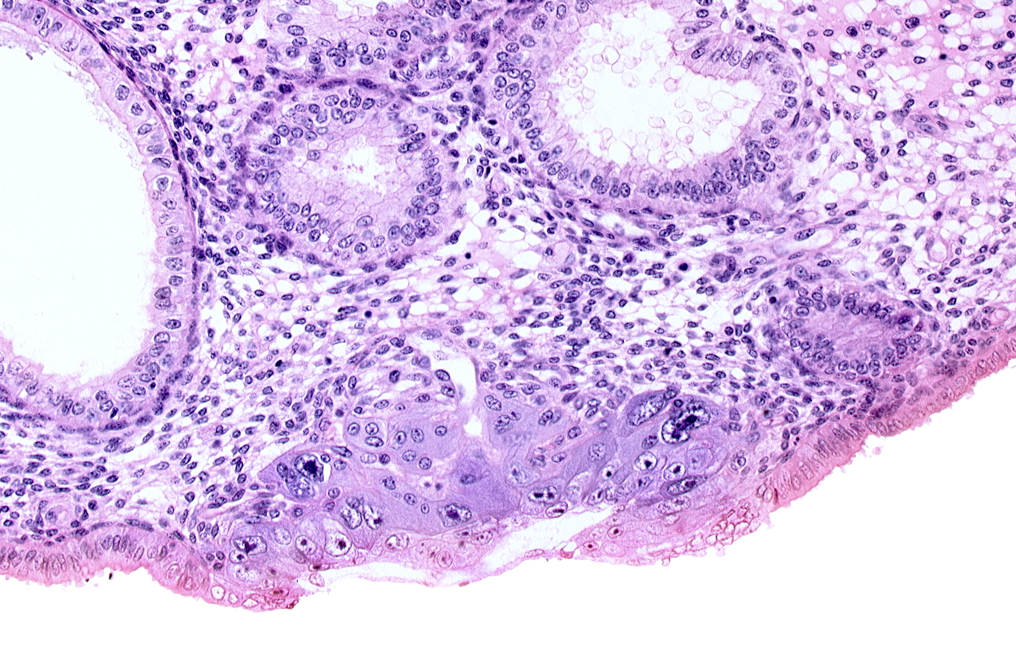 blastocystic cavity (blastocoele), edematous endometrial stroma (decidua), embryonic disc, endometrial gland, endometrial sinusoid, membranous trophoblast at abembryonic pole