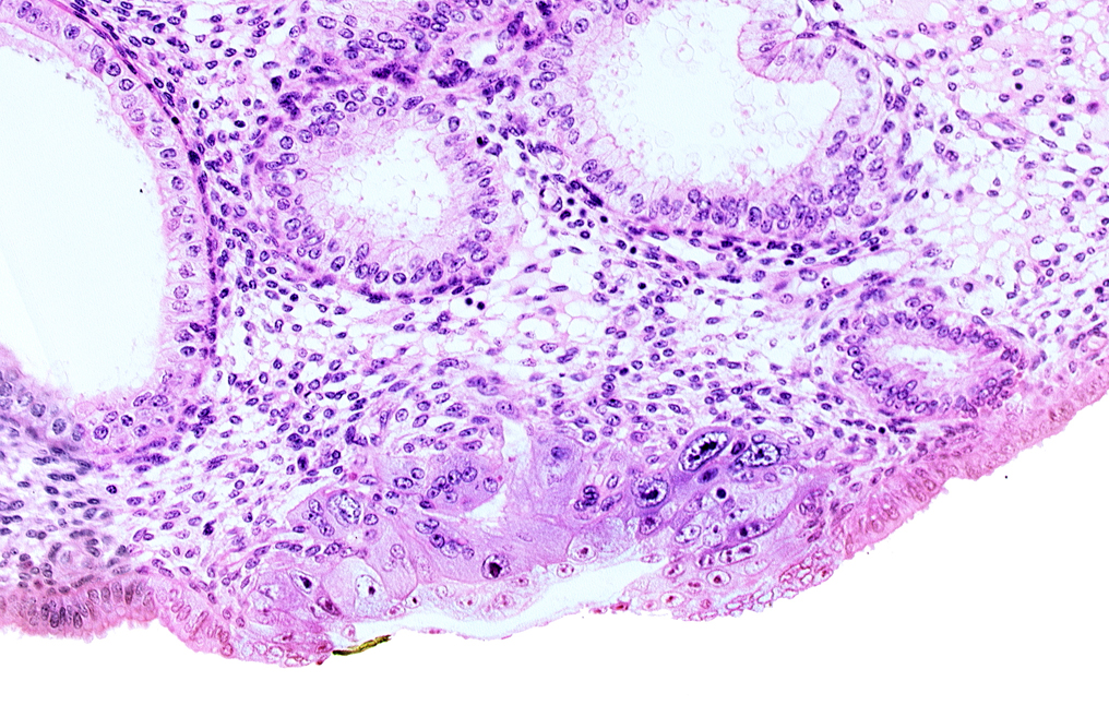 blastocystic cavity (blastocoele), cytotrophoblast, edematous endometrial stroma (decidua), endometrial epithelium, endometrial sinusoid, membranous trophoblast at abembryonic pole, solid syncytiotrophoblast, uterine cavity