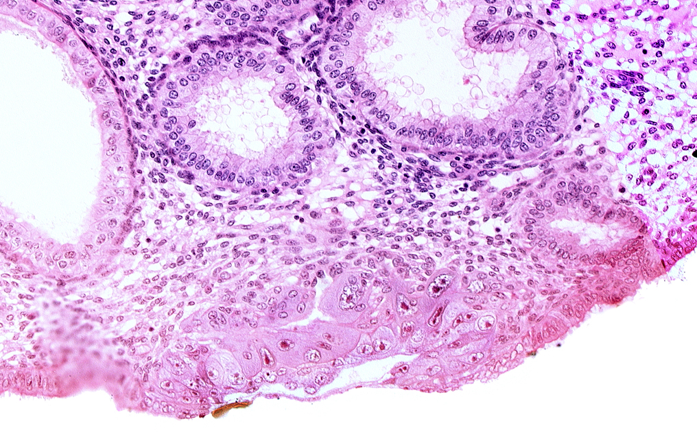 blastocystic cavity (blastocoele), cytotrophoblast, embryonic disc, endometrial sinusoid, extra-embryonic mesoblast, membranous trophoblast at abembryonic pole, solid syncytiotrophoblast