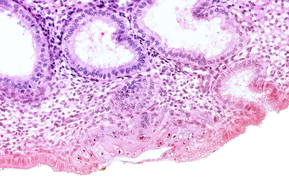 blastocystic cavity (blastocoele), cytotrophoblast, endometrial epithelium, endometrial gland, endometrial sinusoid, membranous trophoblast at abembryonic pole, mouth of endometrial gland, uterine cavity