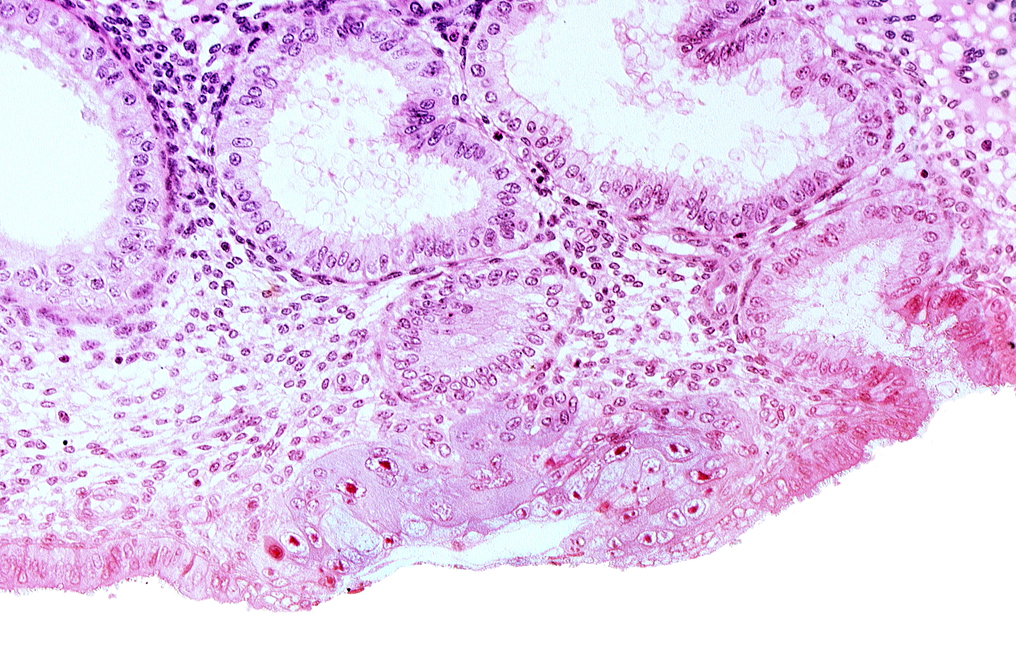 blastocystic cavity (blastocoele), endometrial gland, extra-embryonic mesoblast, lumen of endometrial gland, membranous trophoblast at abembryonic pole, mouth of endometrial gland, uterine cavity