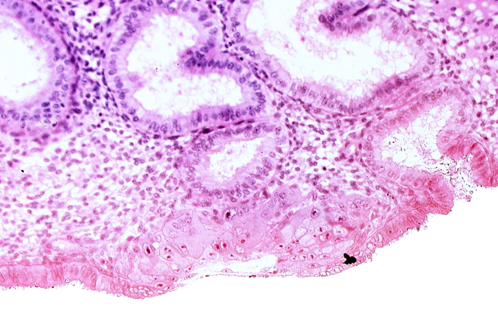 blastocystic cavity (blastocoele), chorion, cytotrophoblast, extra-embryonic mesoblast, lumen of endometrial gland, mouth of endometrial gland, solid syncytiotrophoblast