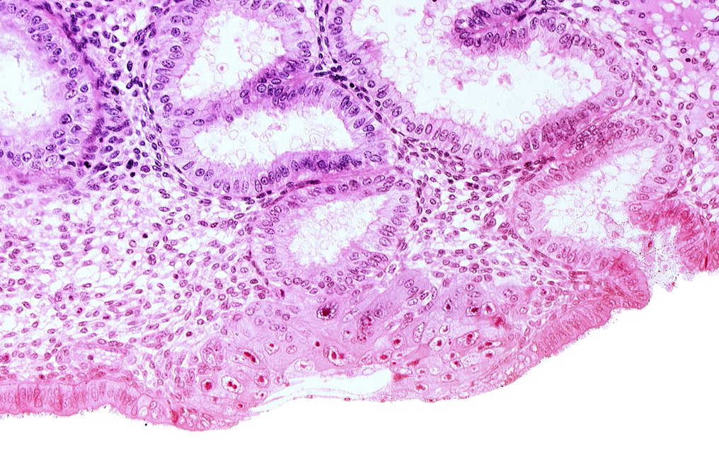 blastocystic cavity (blastocoele), cytotrophoblast, junction of endometrial gland and syncytiotrophoblast, lumen of endometrial gland, membranous trophoblast at abembryonic pole, solid syncytiotrophoblast