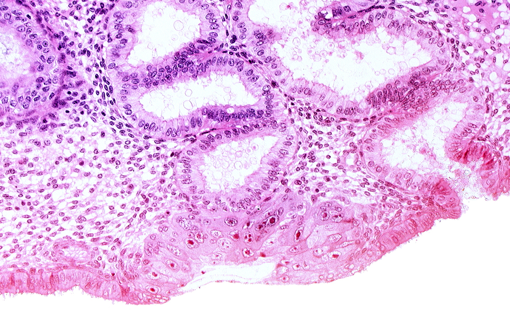 blastocystic cavity (blastocoele), endometrial epithelium, endometrial gland, membranous trophoblast at abembryonic pole, mouth of endometrial gland, solid syncytiotrophoblast, uterine cavity