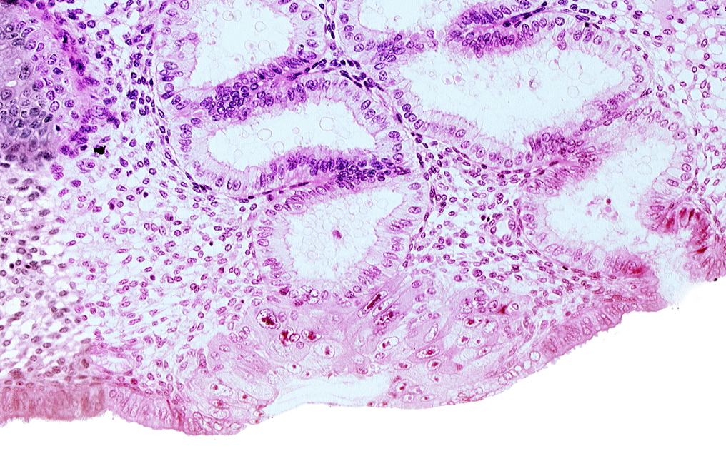 blastocystic cavity (blastocoele), endometrial epithelium, membranous trophoblast at abembryonic pole, solid syncytiotrophoblast