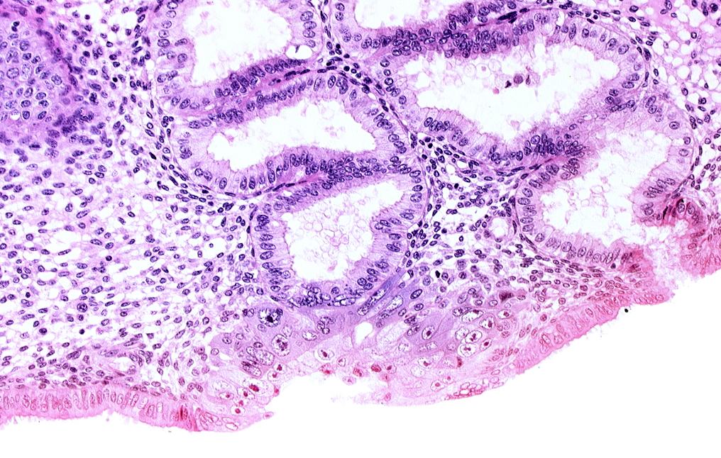 blastocystic cavity (blastocoele), endometrial epithelium, endometrial gland, endometrial sinusoid, membranous trophoblast at abembryonic pole, solid syncytiotrophoblast, space(s) within syncytiotrophoblast