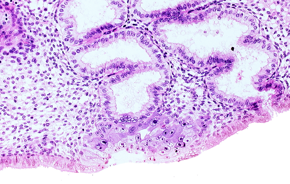 blastocystic cavity (blastocoele), cytotrophoblast, endometrial epithelium, endometrial sinusoid, junction of endometrial gland and syncytiotrophoblast, membranous trophoblast at abembryonic pole, space(s) within syncytiotrophoblast