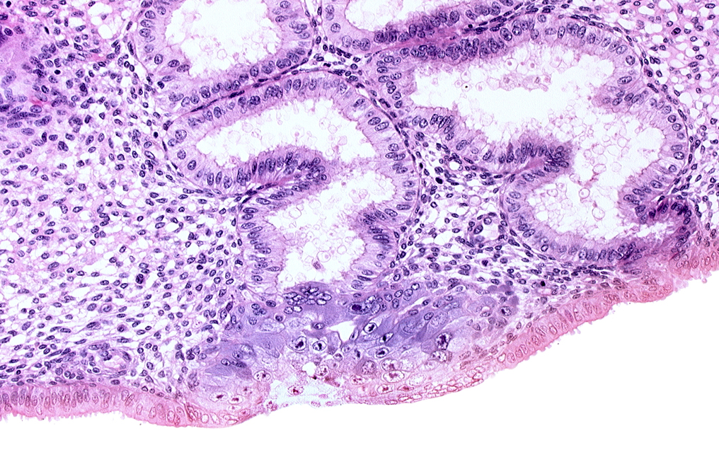 cytotrophoblast, edge of blastocystic cavity (blastocoele), endometrial gland, endometrial sinusoid, extra-embryonic mesoblast, membranous trophoblast at abembryonic pole, space(s) within syncytiotrophoblast