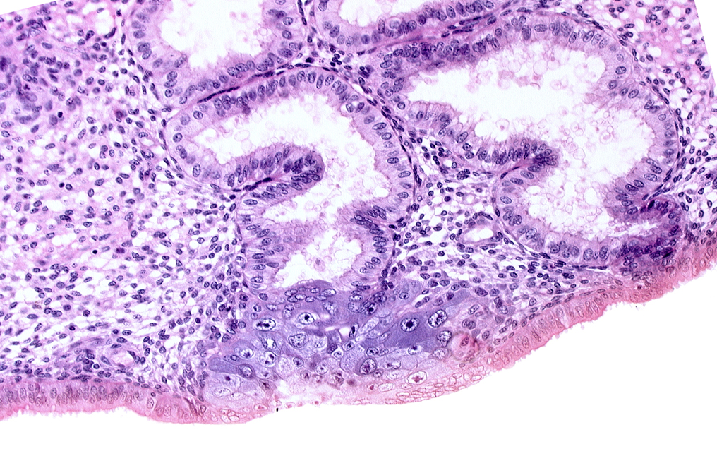 cytotrophoblast, edematous endometrial stroma (decidua), endometrial epithelium, endometrial gland, endometrial sinusoid, membranous trophoblast at abembryonic pole, solid syncytiotrophoblast