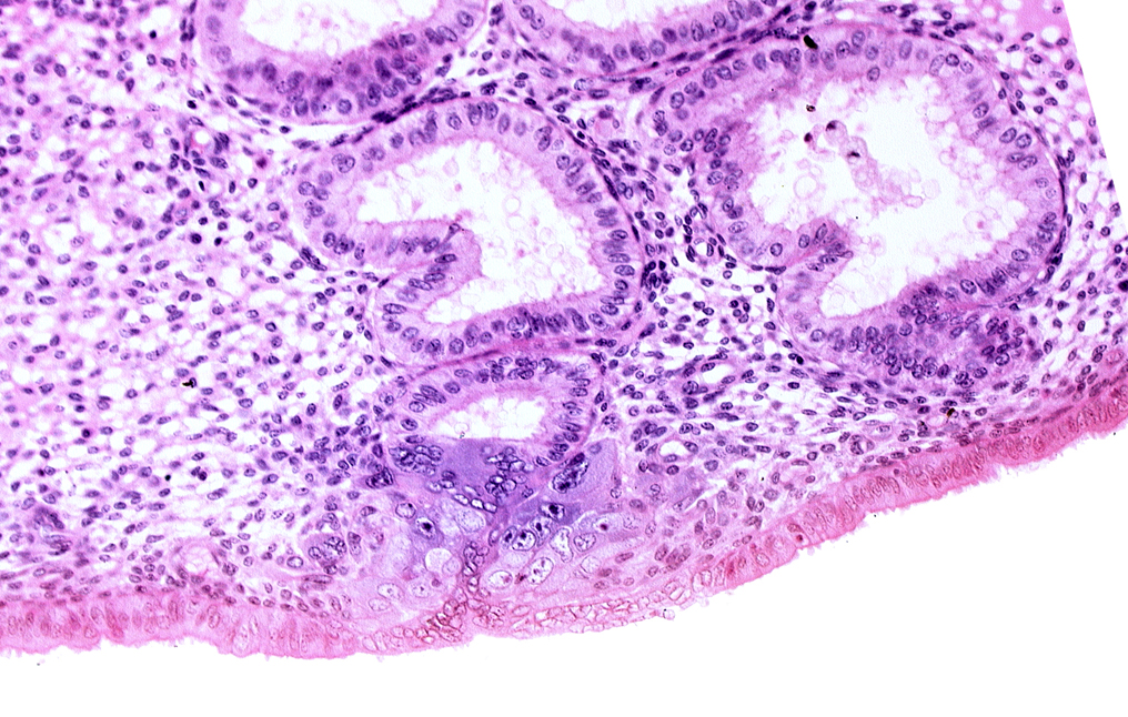 cytotrophoblast, endometrial epithelium, endometrial gland, endometrial sinusoid, solid syncytiotrophoblast, uterine cavity