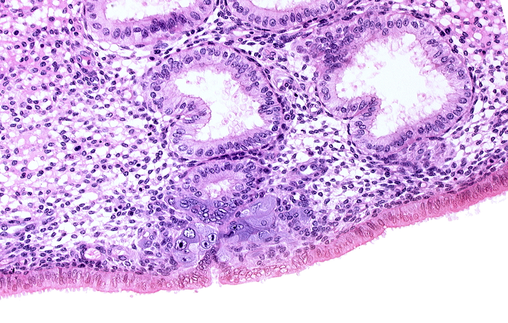 endometrial epithelium, endometrial gland, endometrial sinusoid, solid syncytiotrophoblast, syncytiotrophoblast engulfing endometrial gland cells